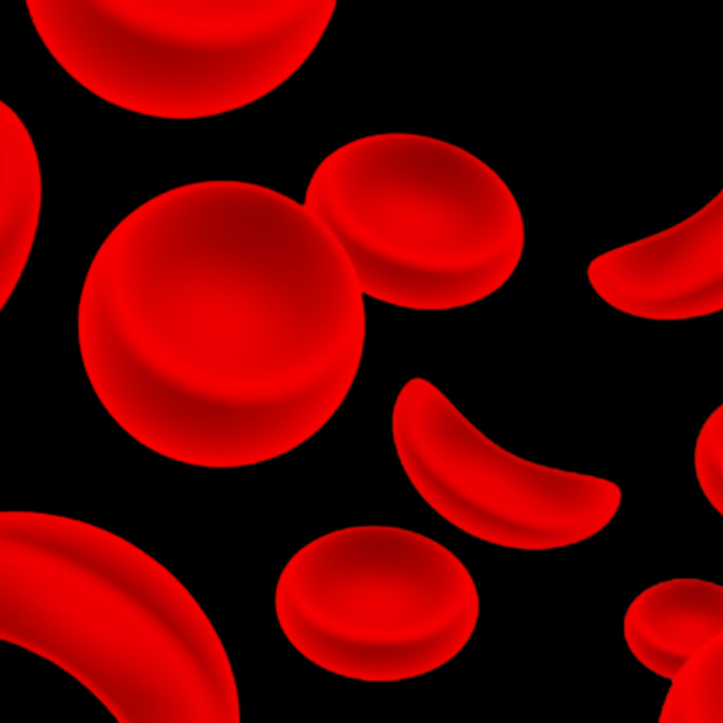 sickle cell graphic